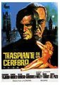 Trasplante de un cerebro海报