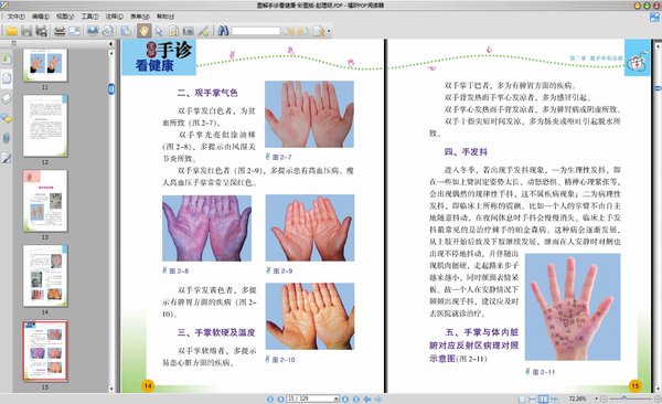 《图解手诊看健康·彩图版》扫描版[PDF]