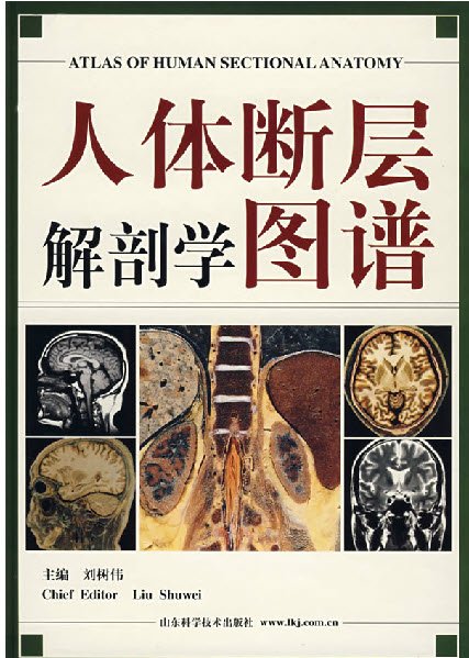 《人体MRI图谱》扫描版[PDF]