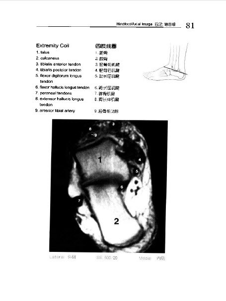 《人体MRI图谱》扫描版[PDF]